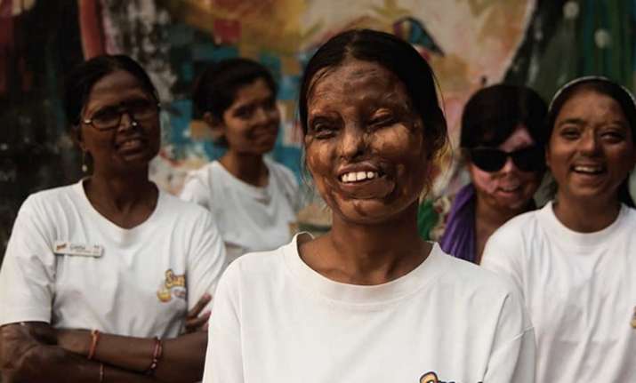 Acid attack victims to find a career in tattoo art