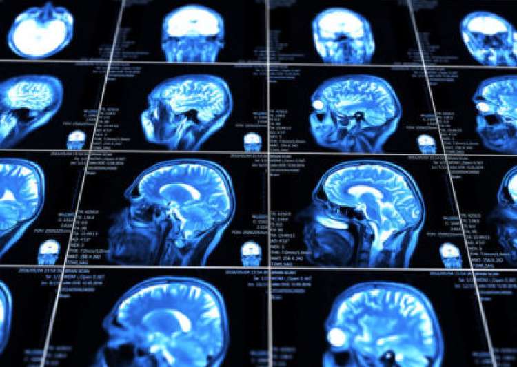 Boost mental clarity photo 1