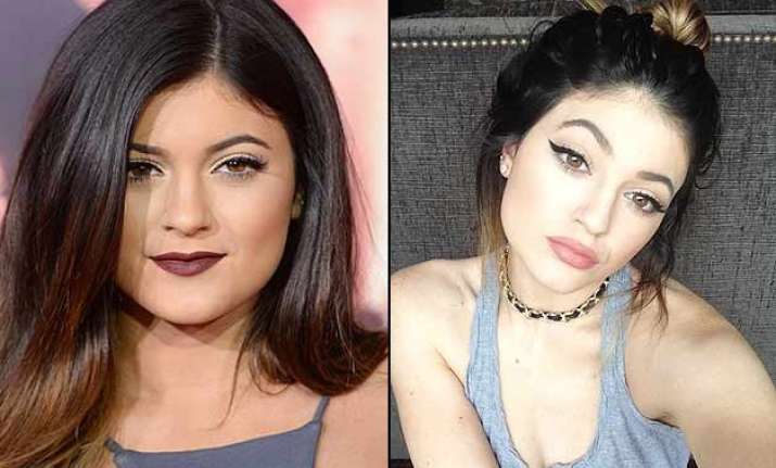 Kylie Jenner Finally Opens Up On Plastic Surgery