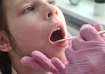 Adenoiditis
