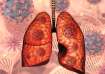 lung cancer awareness month