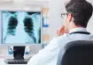 Early signs of lung cancer that can help in diagnosis