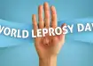 World Leprosy Day 2025