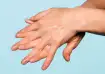 sweaty hands home remedies