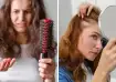 Hair thinning in women after 40 showing visible scalp and wider hair parting