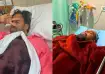 Bosco Martis hospitalised after chest discomfort