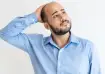 hair loss at young age
