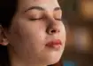 skincare dark spots