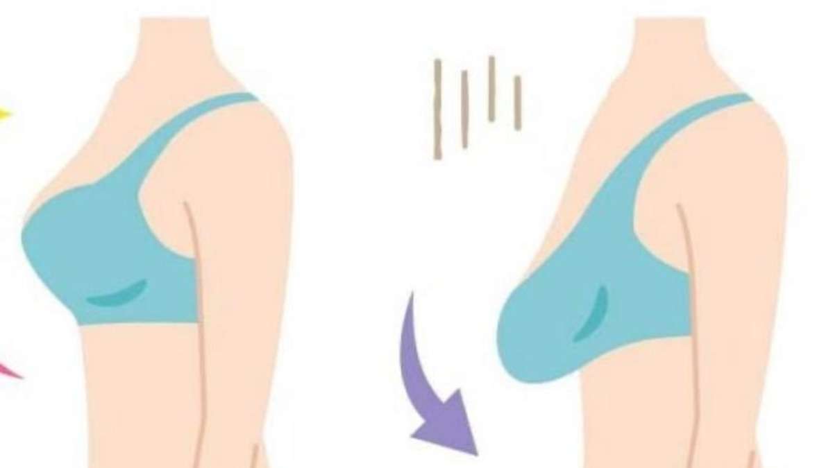 Breast Support, Improve the Sagging Chest Soft and Skin‑friendly