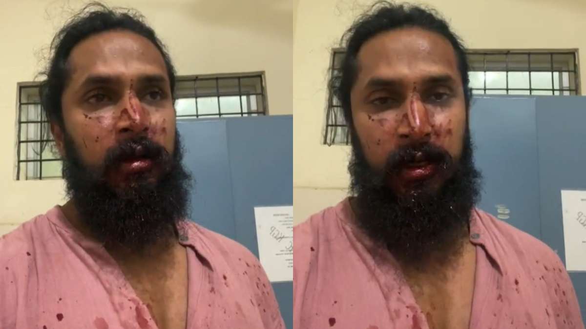 Kannada actor Chetan Chandra injured in mob attack