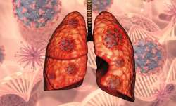 Know importance of early diagnosis for lungs