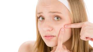 Get rid of acne