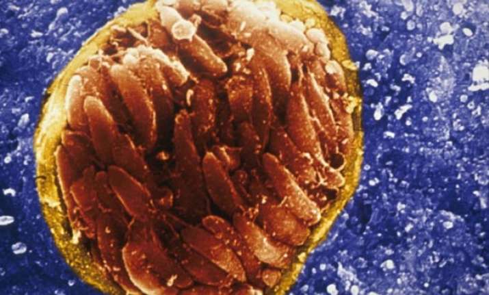 Brain Parasite