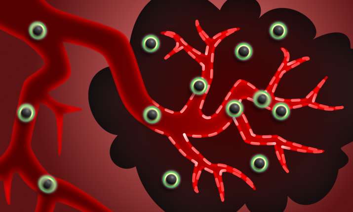Blood Cancer Treatment- India TV