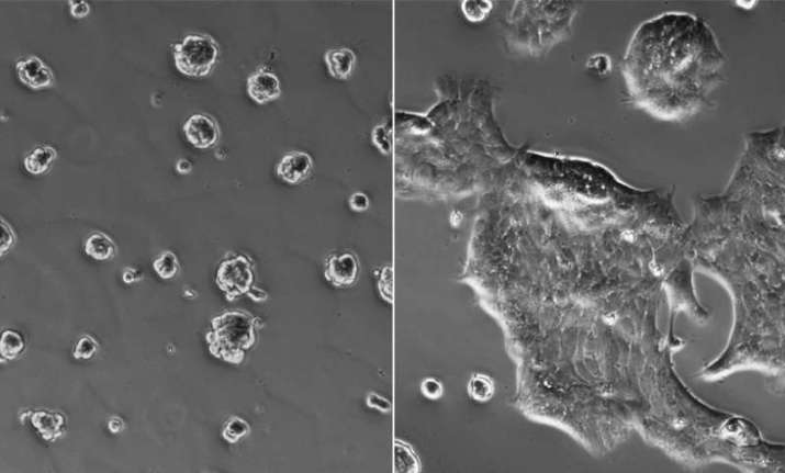 Lack of oxygen at a tumour's core may develop cancer cells