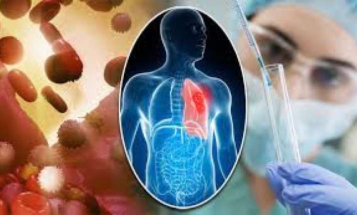 Scientists develop new technique to fine-tune cancer