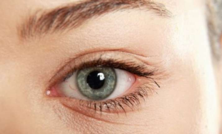 This eye-wrinkle feature are called the Duchenne marker