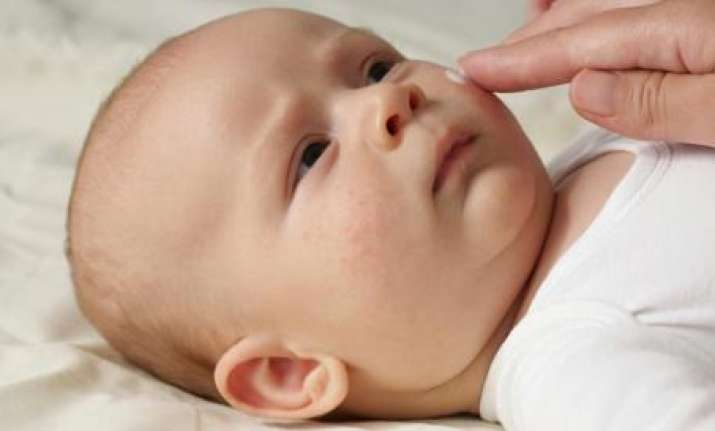 Manage dry and itchy skin in babies