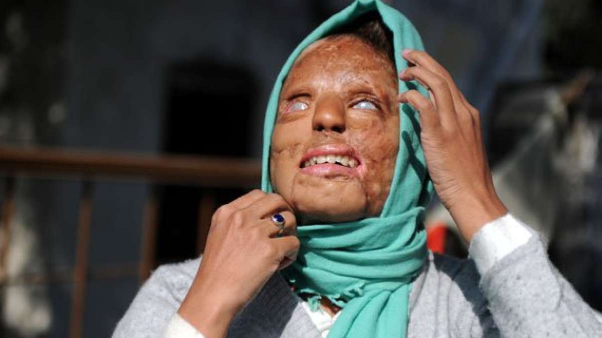 acid attacks what india should learn from bangladesh