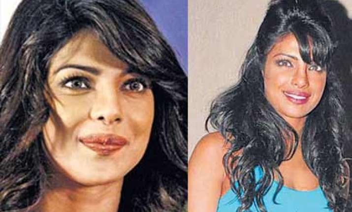 priyanka gets a nose job done