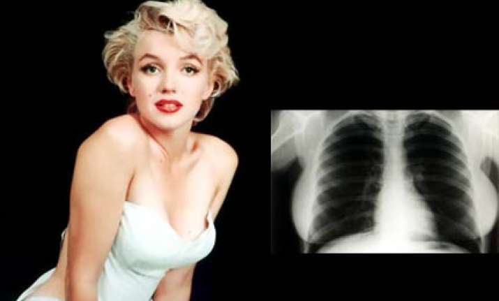 marilyn monroe x rays snapped up for 45 000