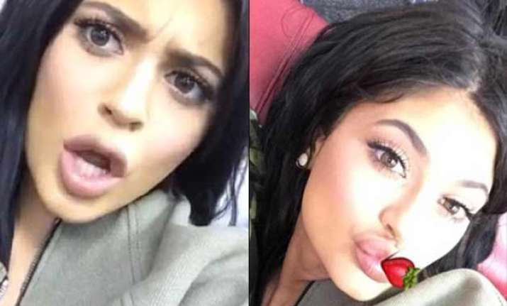 kylie jenner shocks fans with more swollen lips