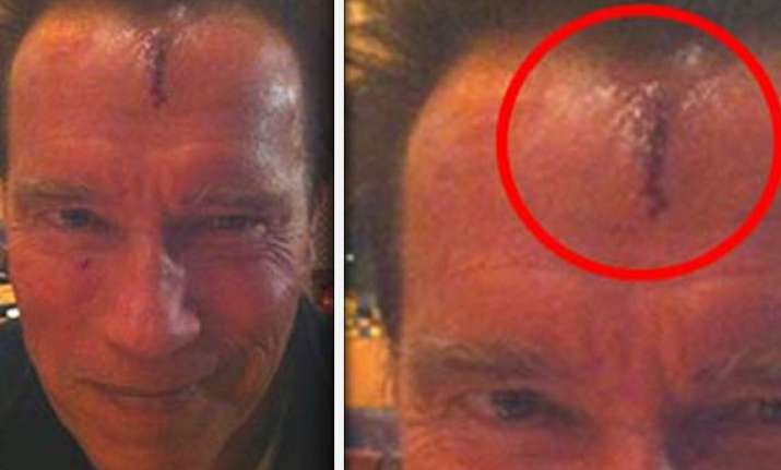 schwarzenegger bruised and battered shooting movie