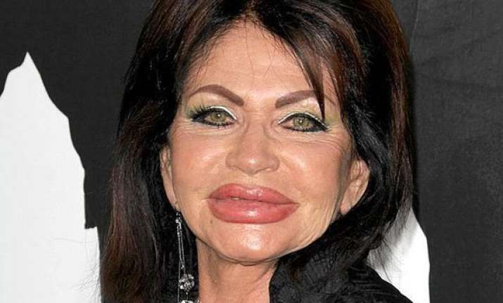 surgery has left me look like chipmunk jackie stallone