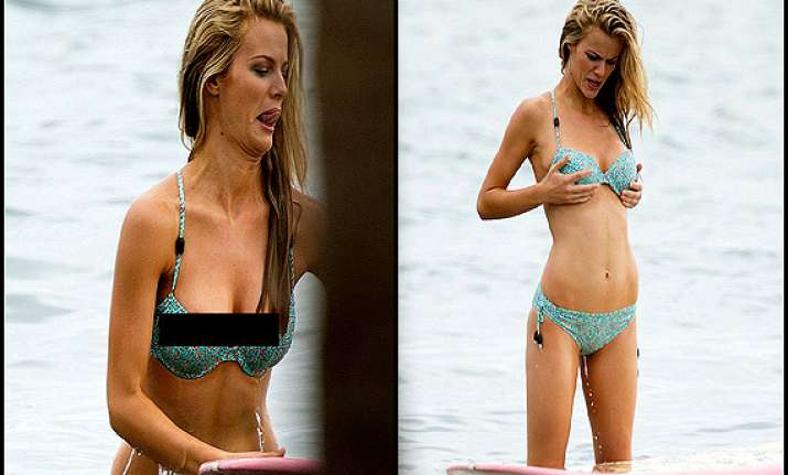 Brooklyn Decker Wardrobe Malfunction During Vogue Photoshoot See Pics