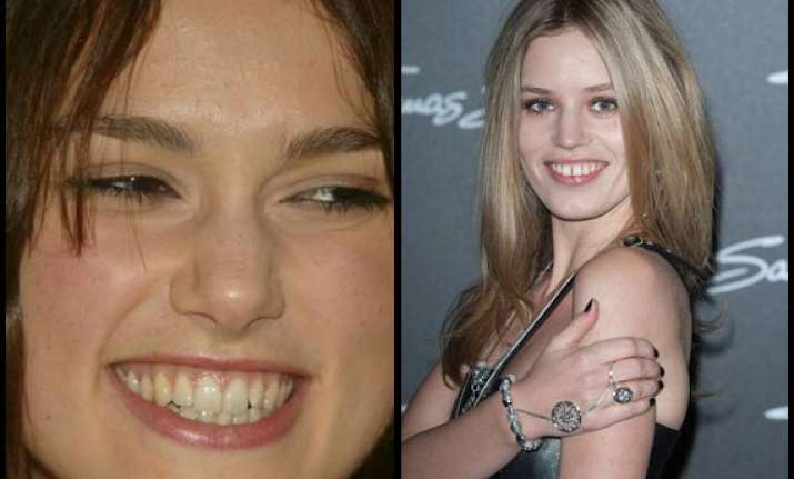 flaunt your imperfect smile