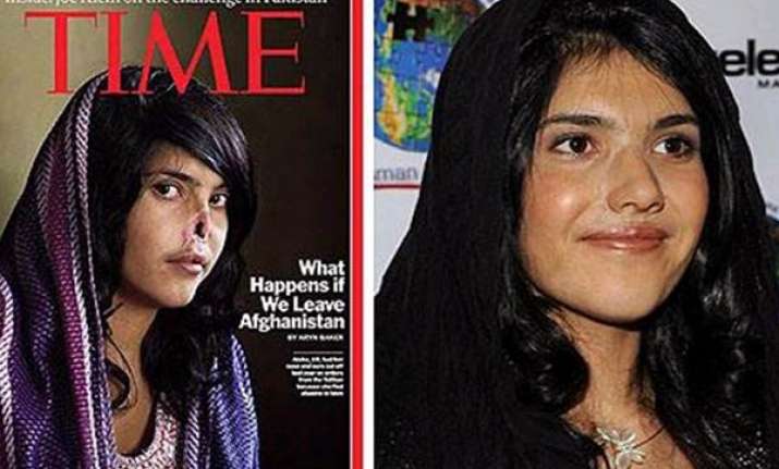 disfigured by taliban afghan girl ayesha gets a prosthetic