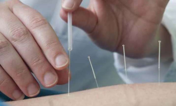 needles removed from abused baby s body in china