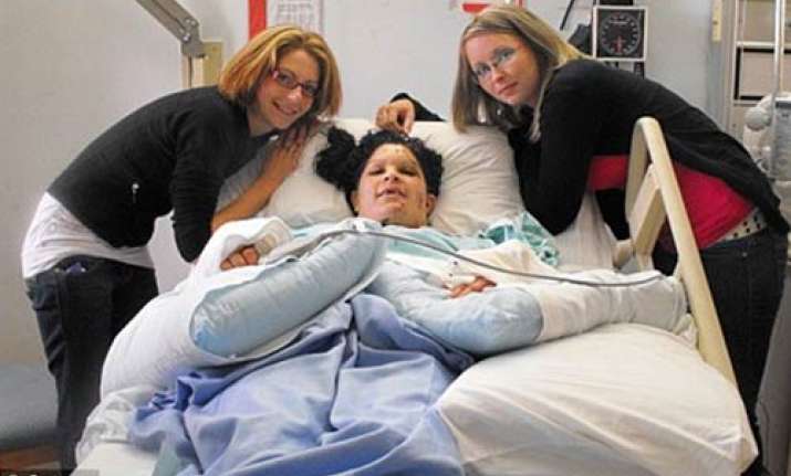 canadian woman falls from seventh storey survives