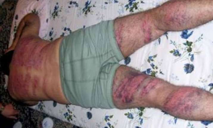 bangladeshi man given 100 lashes in uae for sex with