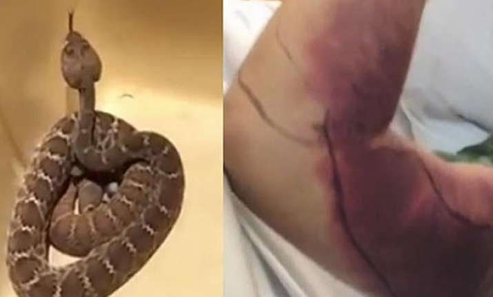 selfie with rattlesnake costs man over 150 000