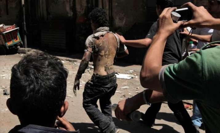 over 1000 injured as protesters clash with police in egypt