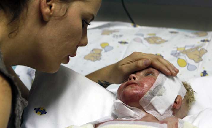 south africa cloned skin recipient to leave hospital