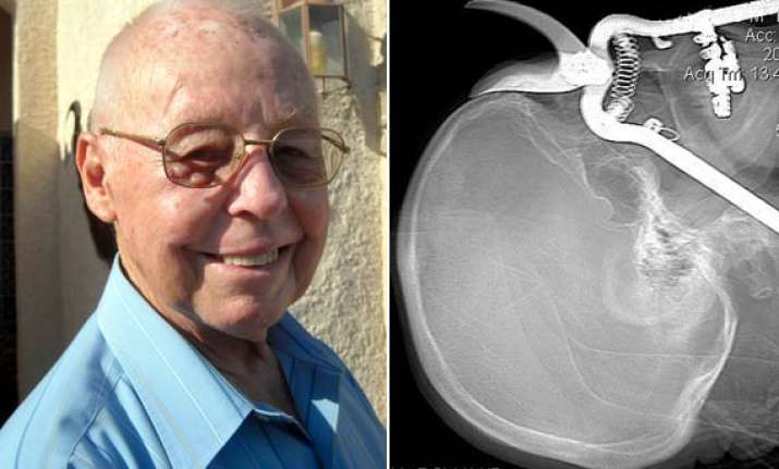 us man impaled through eye socket by pruning shears