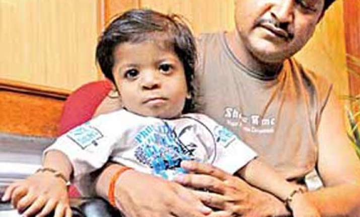 bareilly boy with 34 fingers and toes sets new record