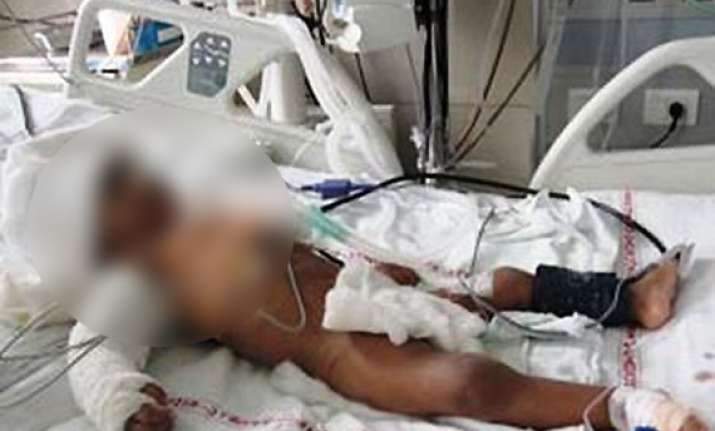 battered falak has shown no sign of recovery yet say doctors