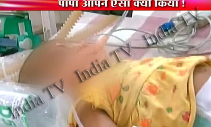 3 month old infant battle for life after bitten and beaten