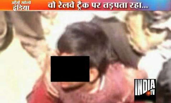callous mp police watches as boy with both legs severed lay