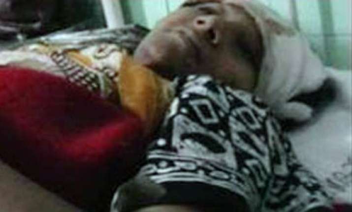 female athlete thrown from moving train by robbers loses a