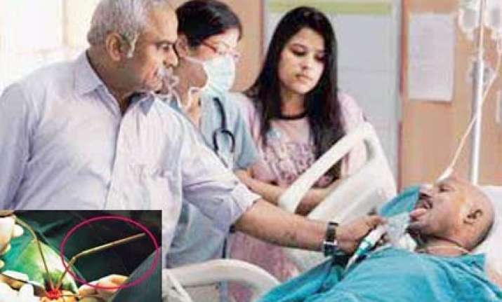 delhi doctors save worker after rod pierces his brain