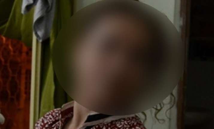 park street rape victim dies