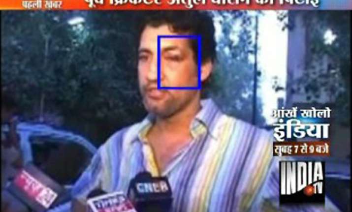 minister s bodyguards assault atul wassan