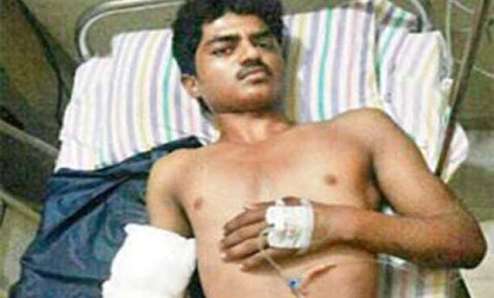 mumbai doctors reattach man s hand severed by electric saw