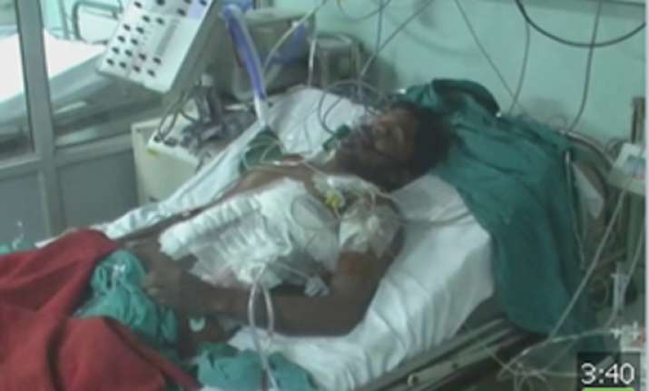 pgi rohtak doctors save man after two iron rods pierced his