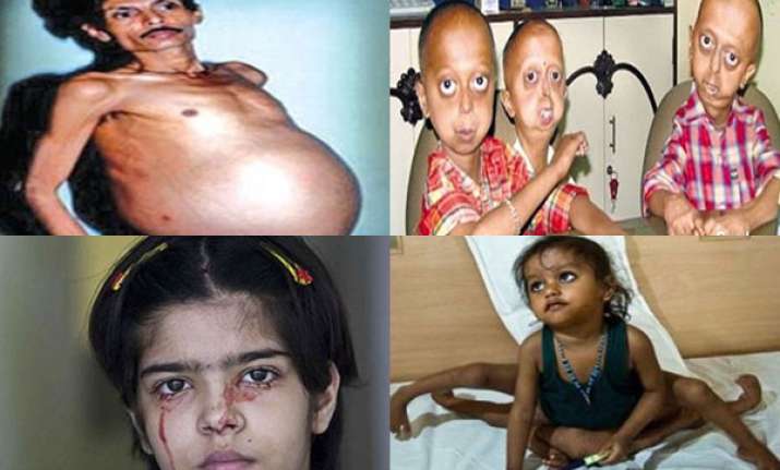 ten big medical anomalies afflicting indians