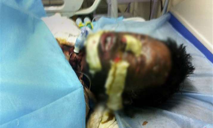 tibetan activist dies immolated himself for protest against